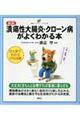 ��ᇐ��咰���E�N���[���a���悭�킩��{�@�V��