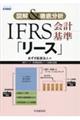IFRS会計基準「リース」