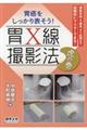 胃癌をしっかり表そう!胃X線撮影法虎の巻