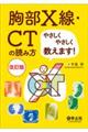 胸部X線・CTの読み方やさしくやさしく教えます! 改訂版第2版
