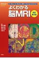 よくわかる脳MRI 改訂第4版