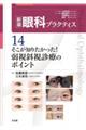 そこが知りたかった!弱視斜視診療のポイント