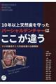 10年以上天然歯を守ったパーシャルデンチャーはここが違う